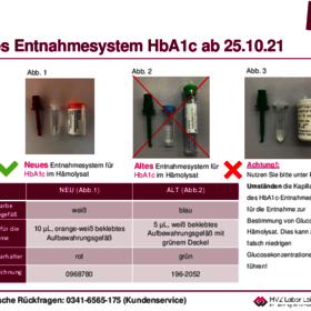 2021-10-25 LI-HbA1c Materialumstellung